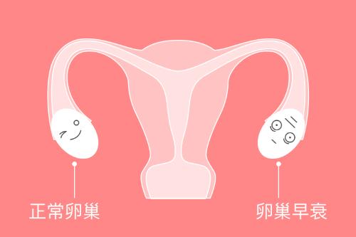 Premature ovarian failure = fertility death sentence?
