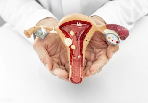 Is it difficult to get pregnant with a posterior uterus: 4 remedies to help get rid of it!
